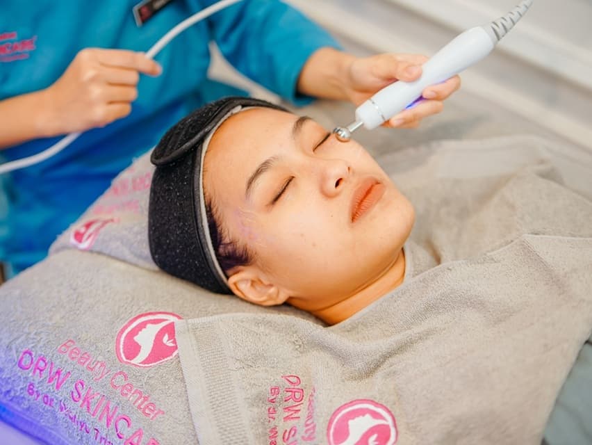 Bagaimana Perawatan Microneedling Bekerja untuk Perbaikan Kulit? Cek di Sini Infonya!